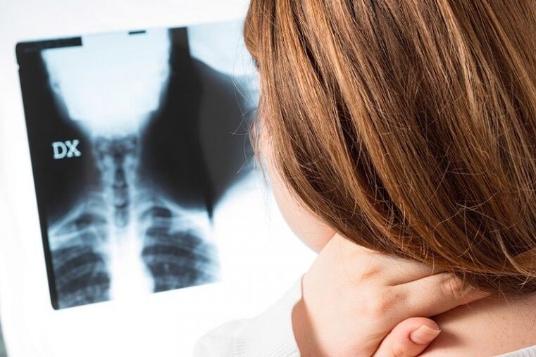 Emakakaela piirkonna x -Ray