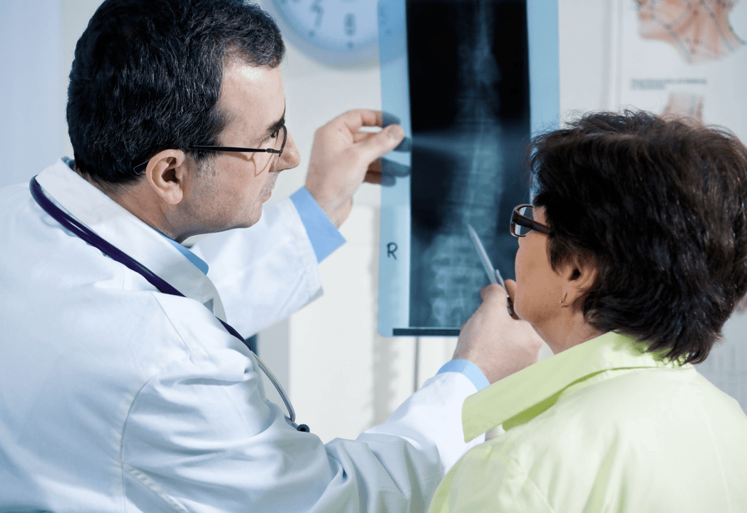 Neuroloog diagnoosib osteokondroosi lülisamba radiograafia abil